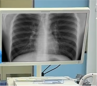 Vscan high-definition endoscope screen