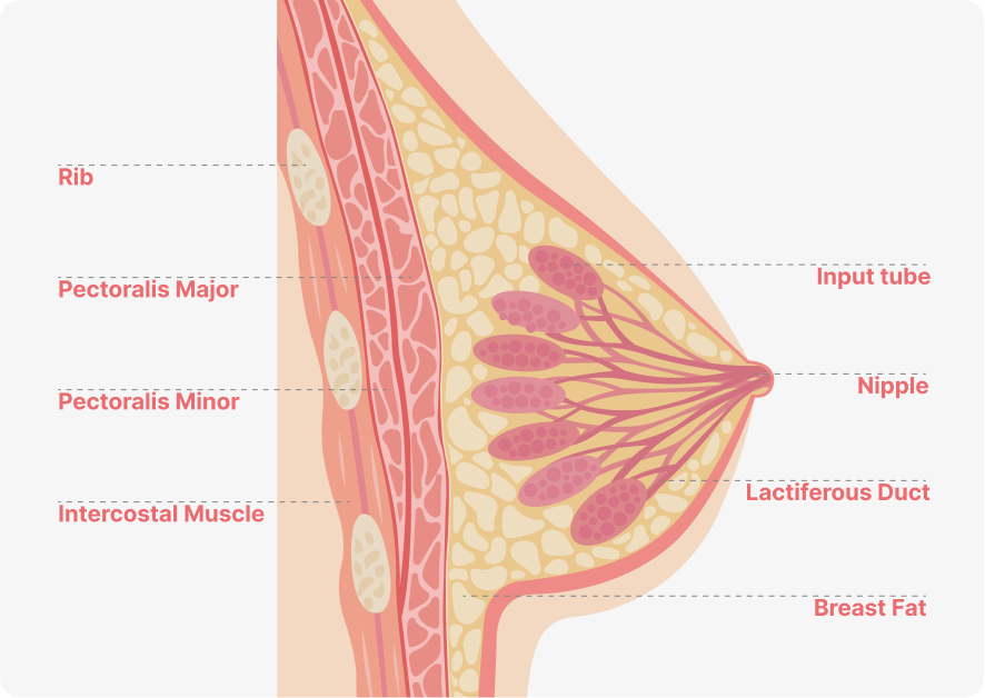 Breast implant placement methods diagram