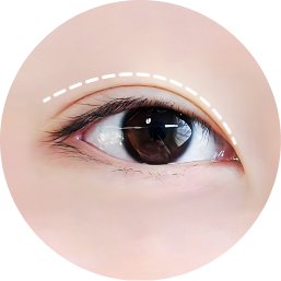 Eye aesthetic analysis