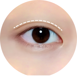 Eye aesthetic analysis