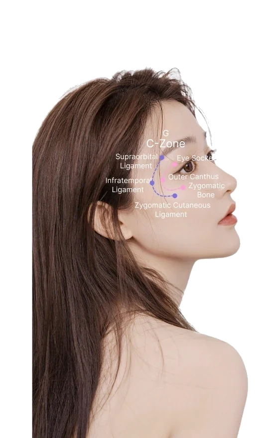 C-Frame Orbital Injection & Lifting