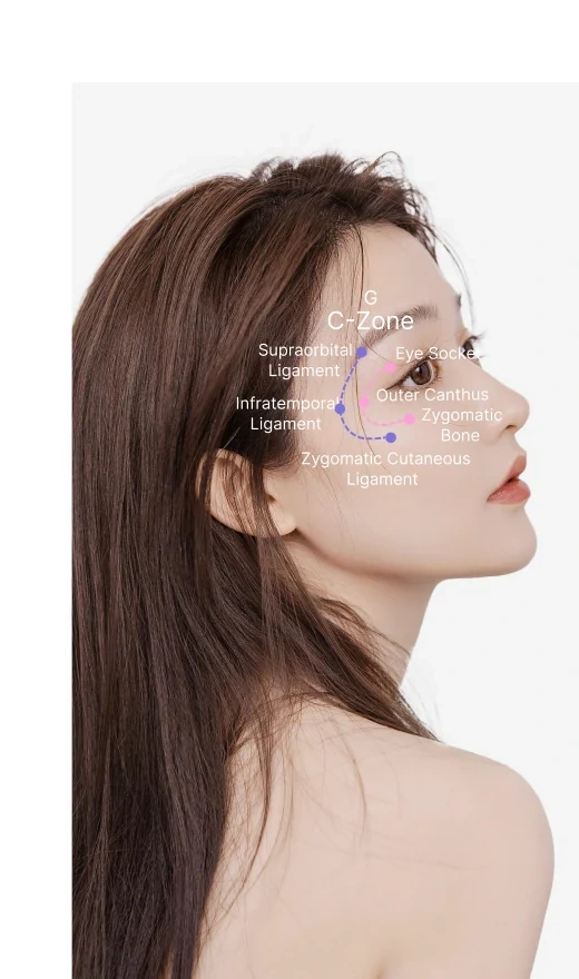 C-Frame Orbital Injection & Lifting