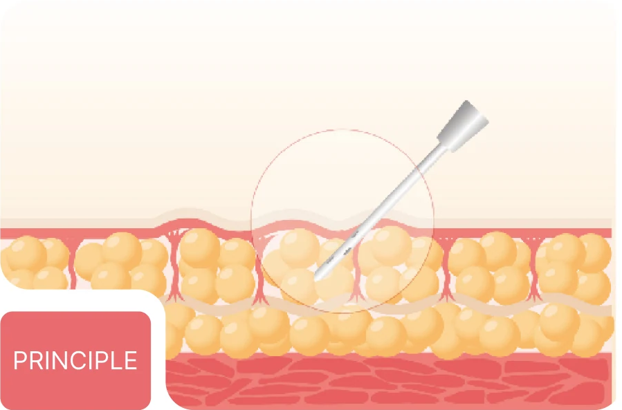 Operating principle illustration
