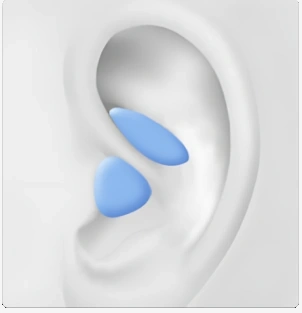 Auricular Cartilage