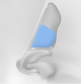 Nasal Septal Cartilage