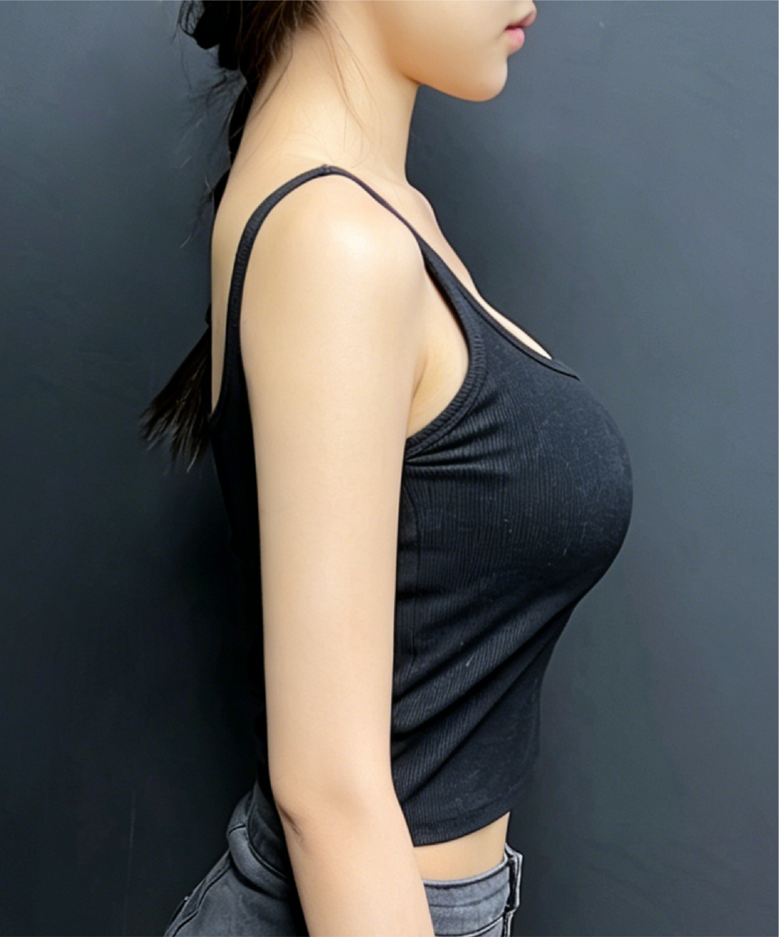 Breast Surgery before