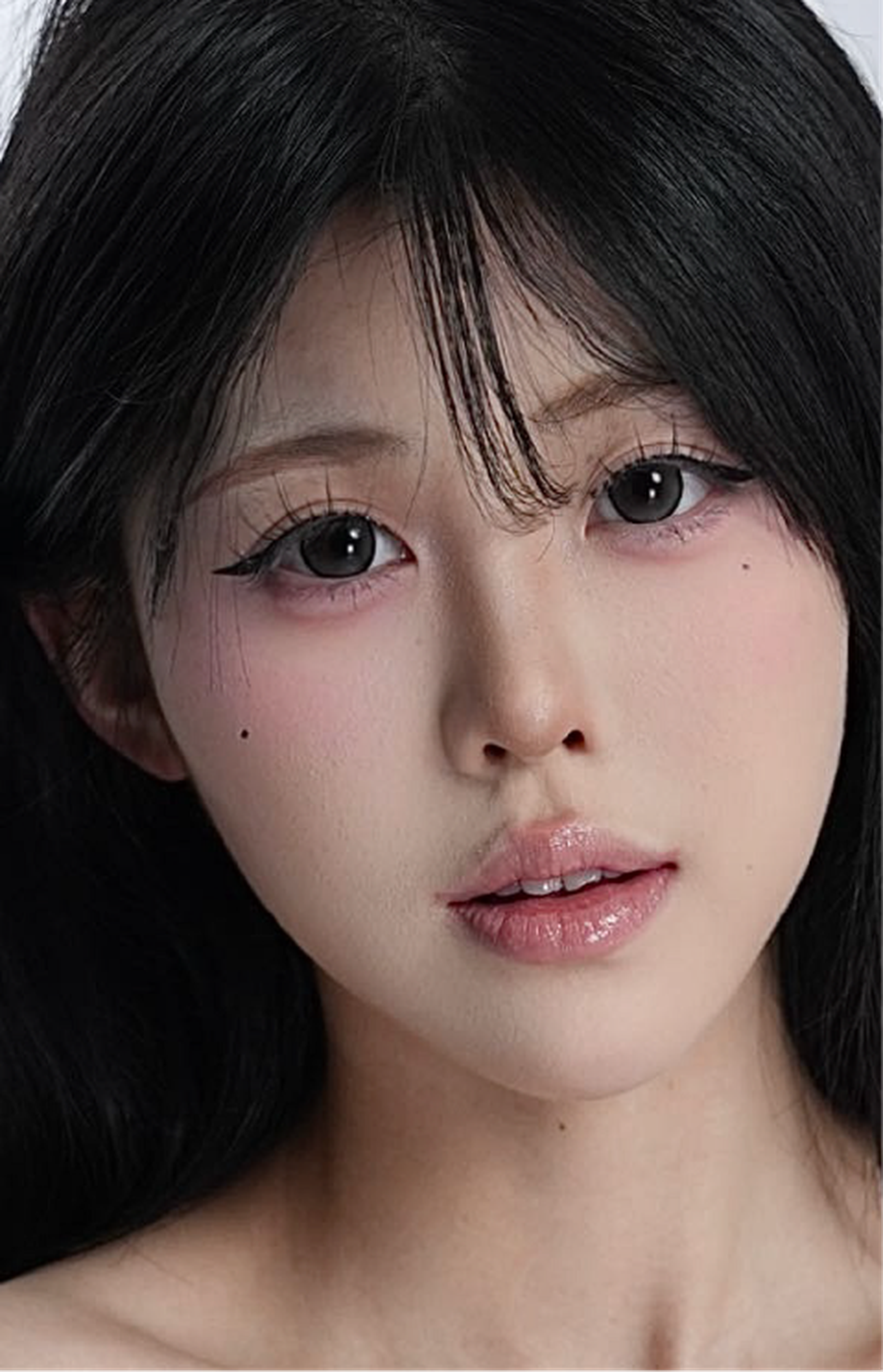 Comprehensive blepharoplasty case 2 feedback left