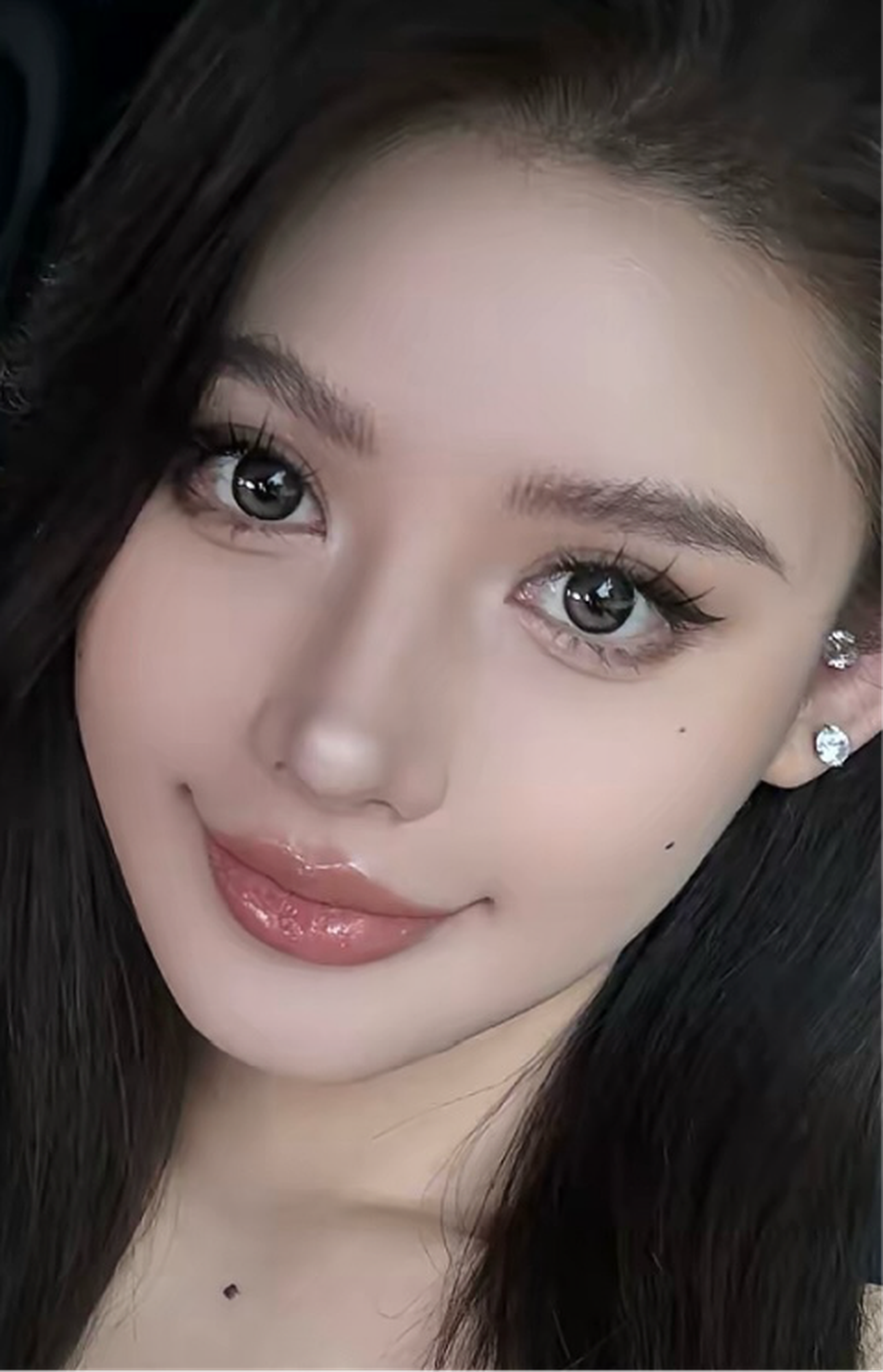 Revision blepharoplasty case 1 feedback right