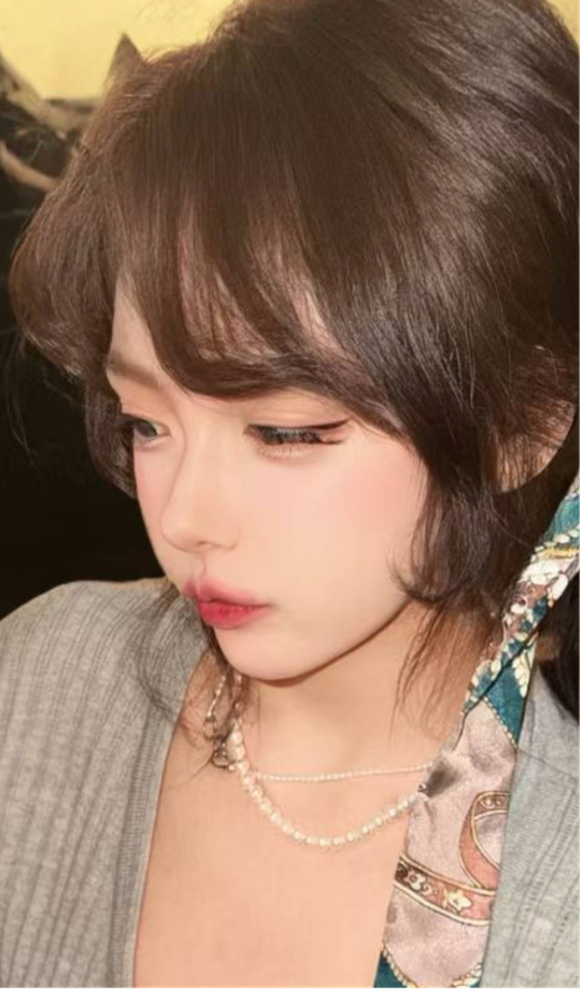 Comprehensive rhinoplasty case 1 feedback right