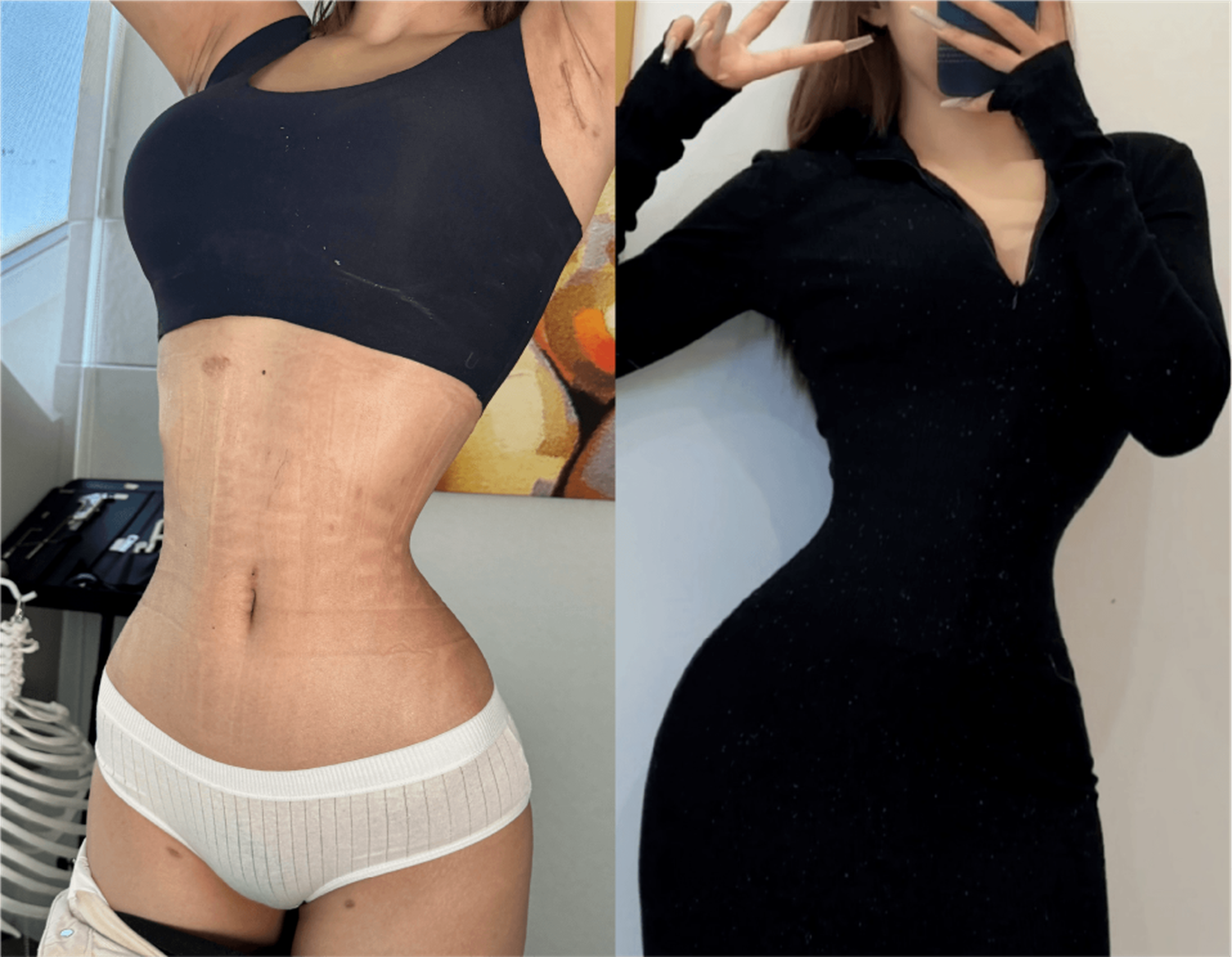 Rib push-in case 2 feedback
