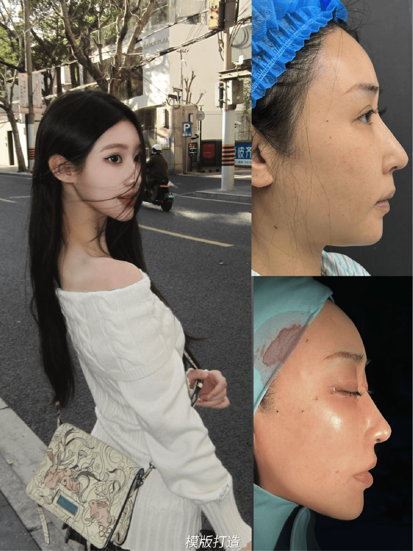 Facial lifting detail collage