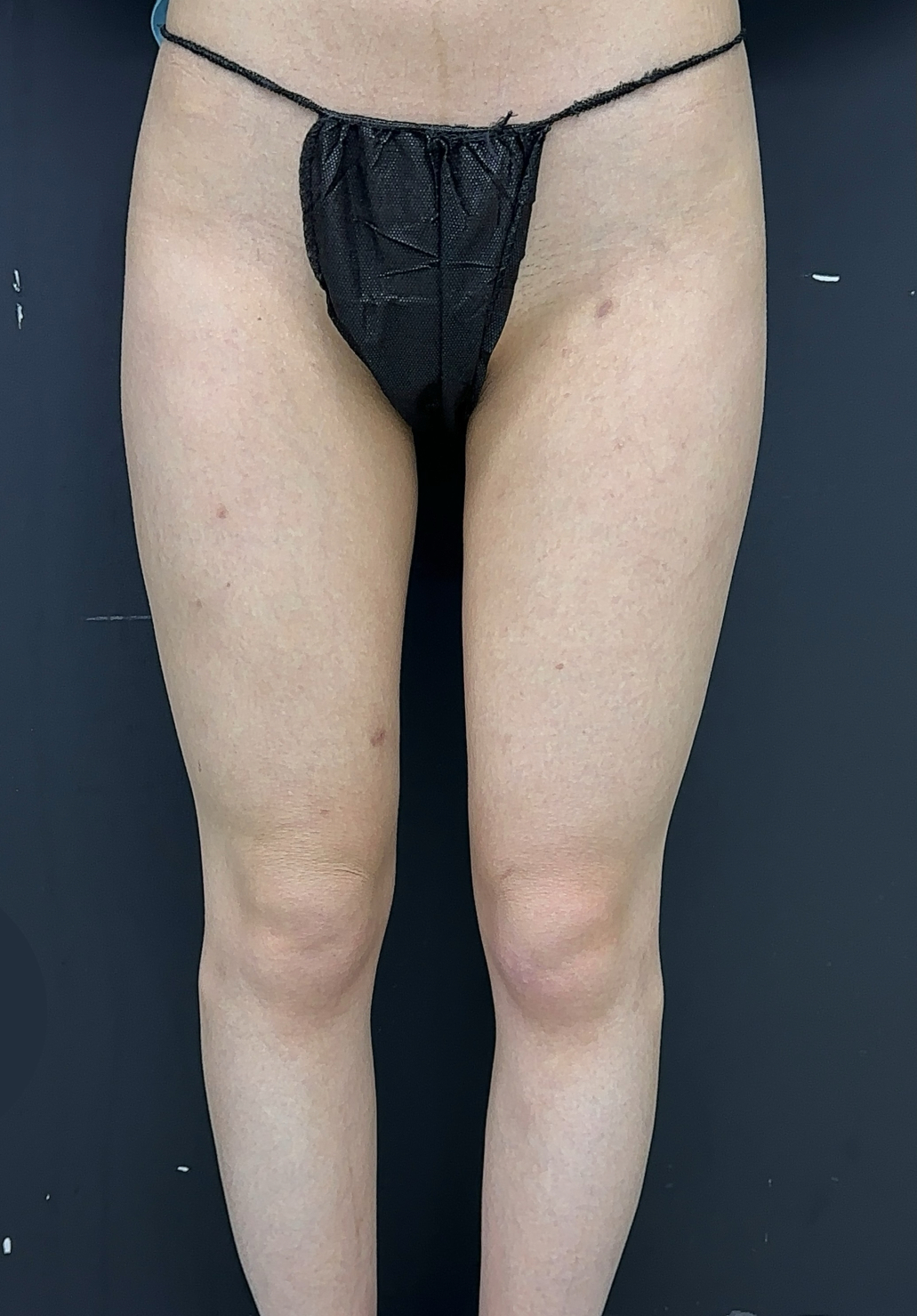 Lower body leg contour after image