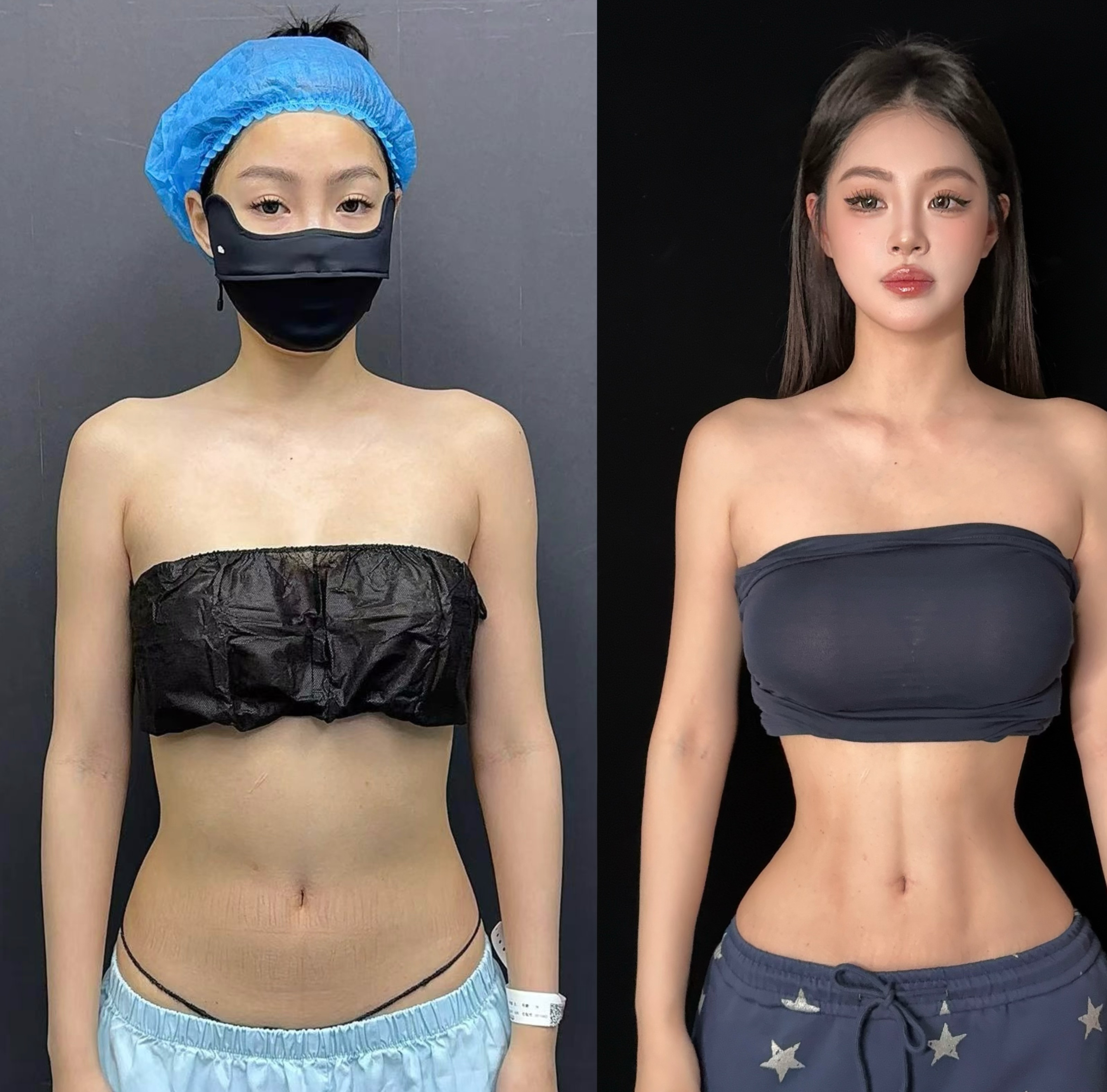 Waist contour front comparison