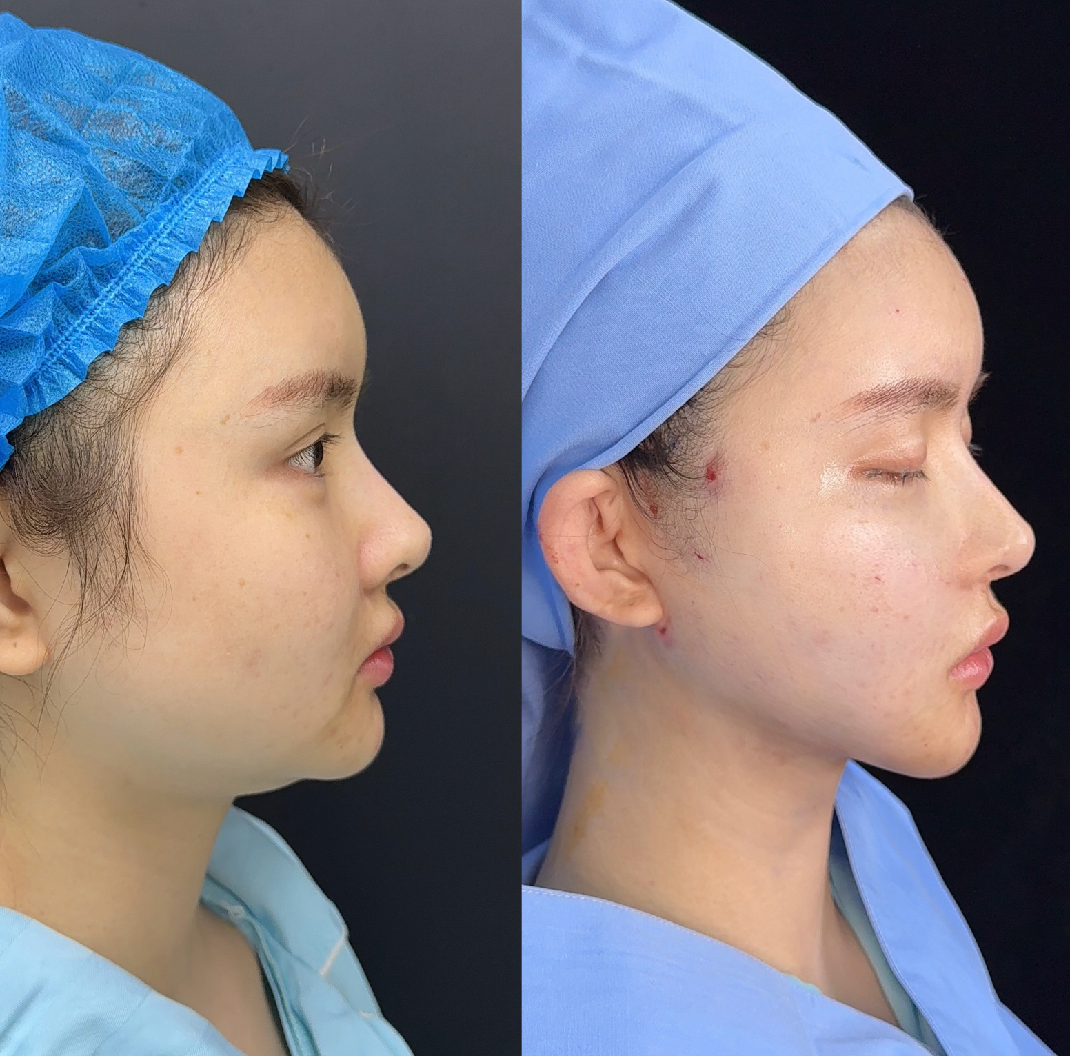 Facial contour side comparison