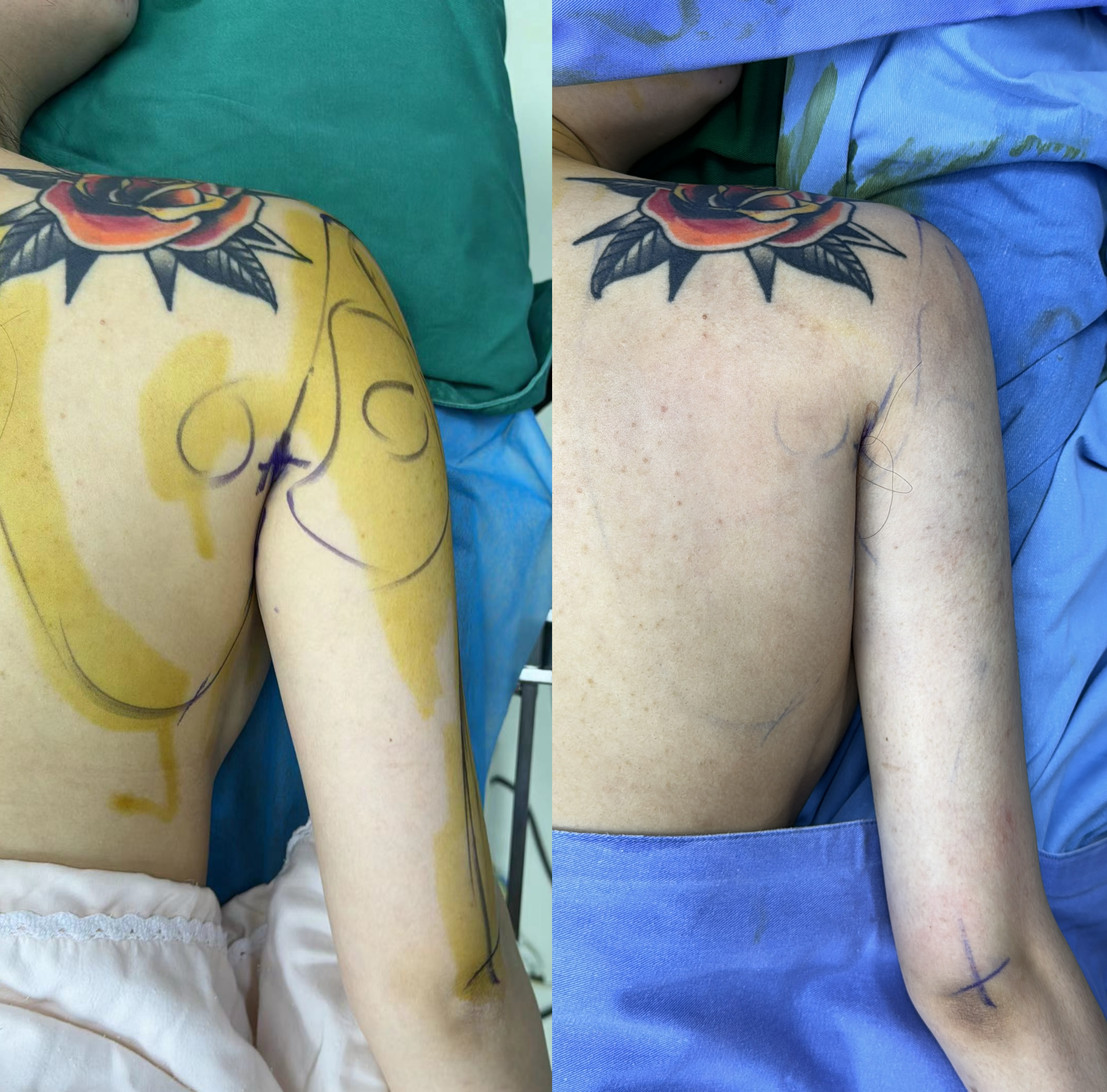 Upper body arm contour comparison
