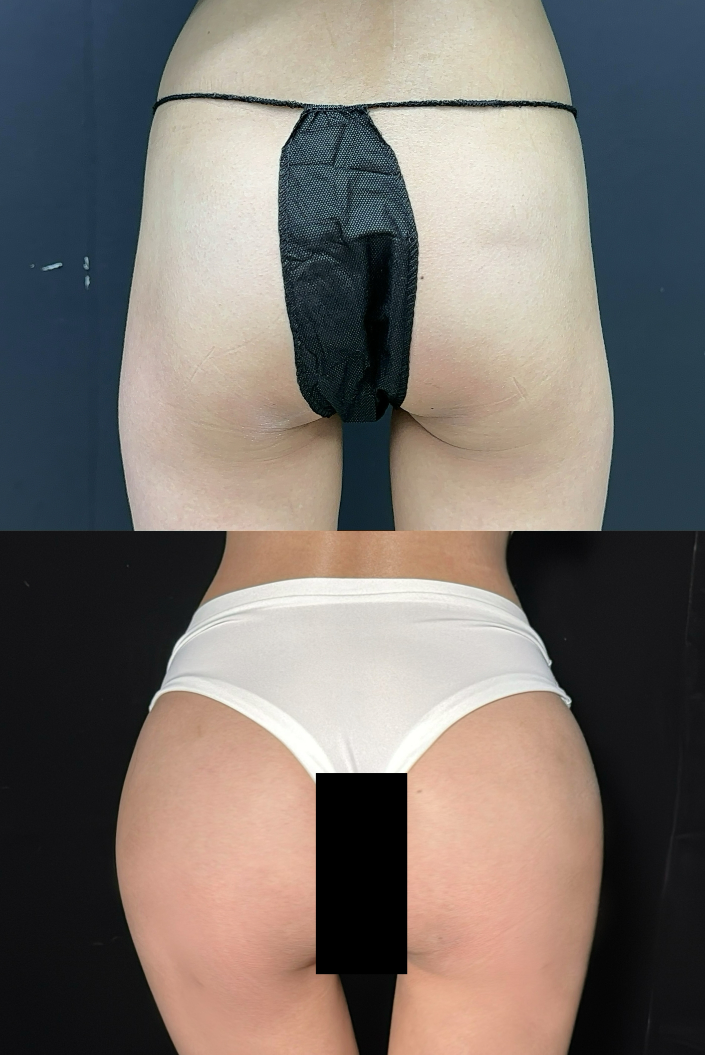 Lower body detail comparison