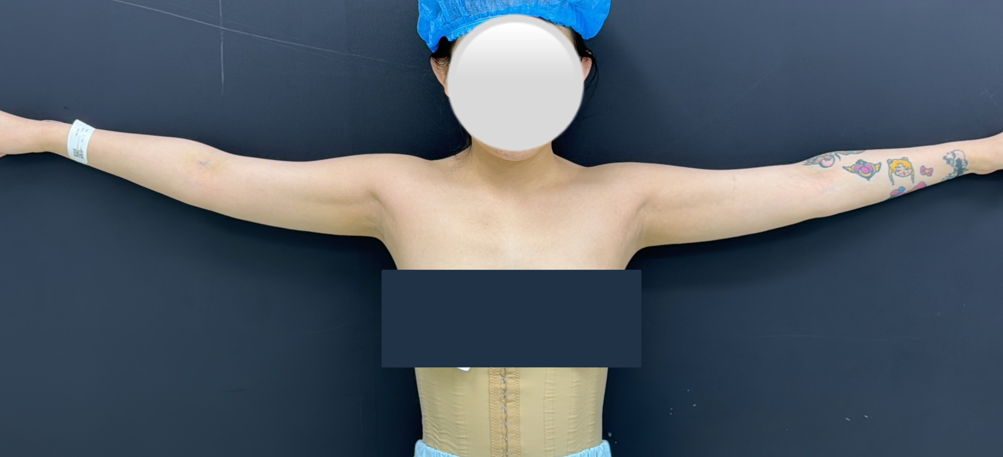 Upper body arm line before image