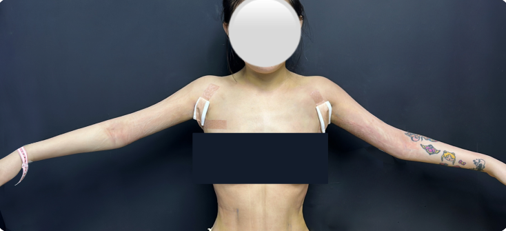 Upper body arm line after image