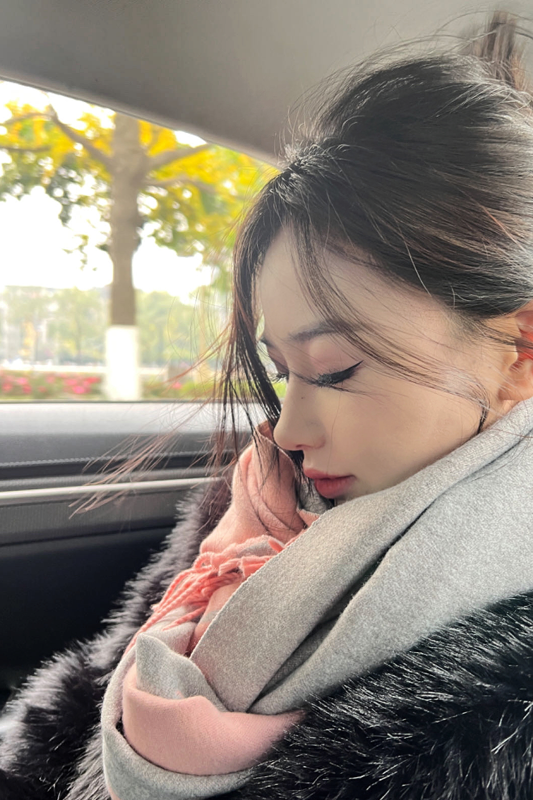 Primary rhinoplasty side portrait