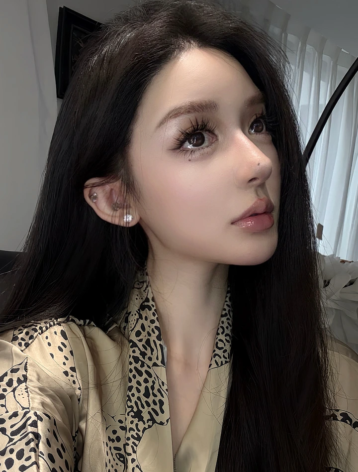 Revision rhinoplasty result portrait