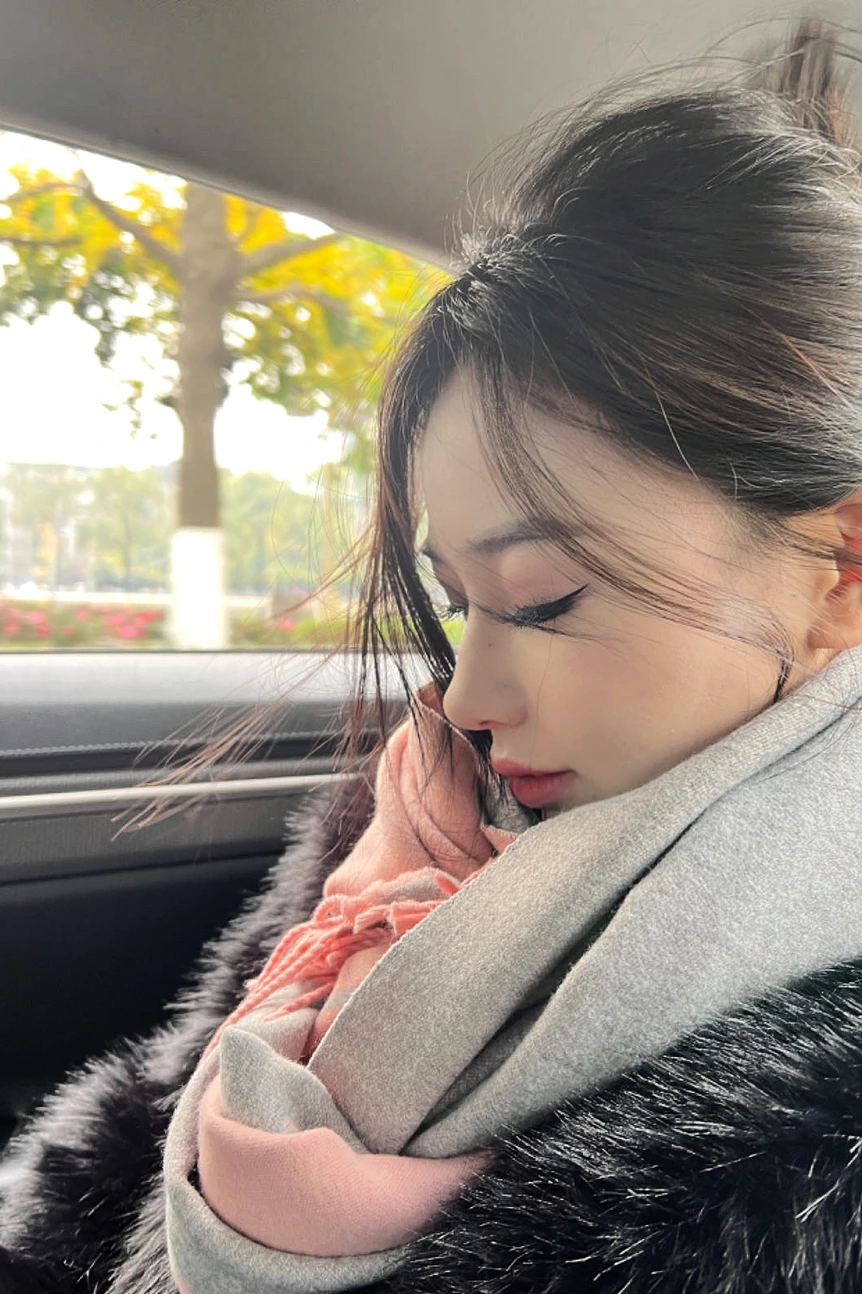 Primary rhinoplasty result portrait outdoors
