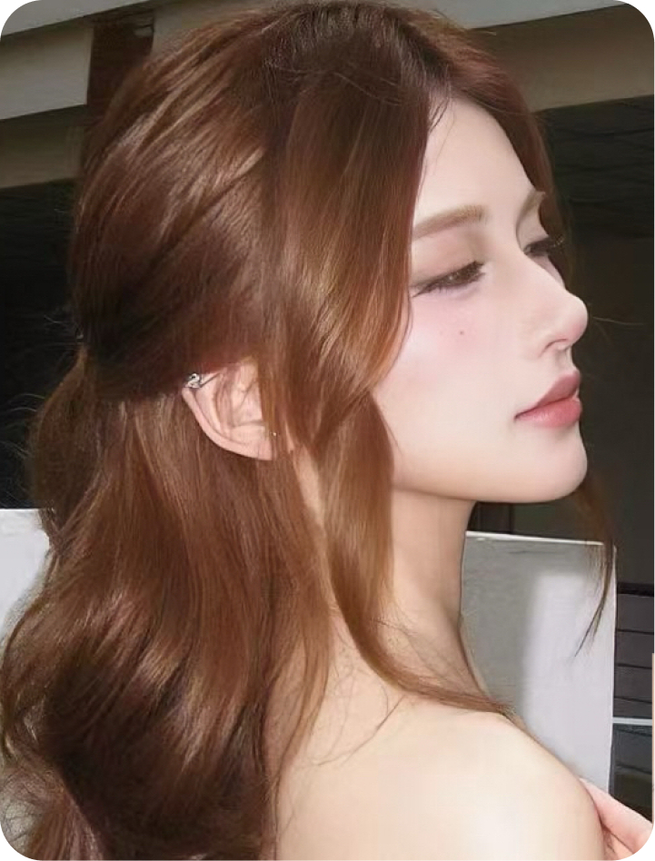 Rhinoplasty case portrait