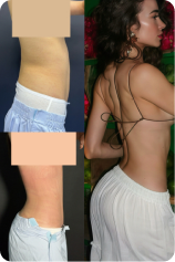 Rib push-in patient result collage