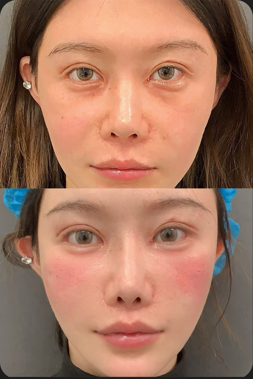 Injectable treatment case detail
