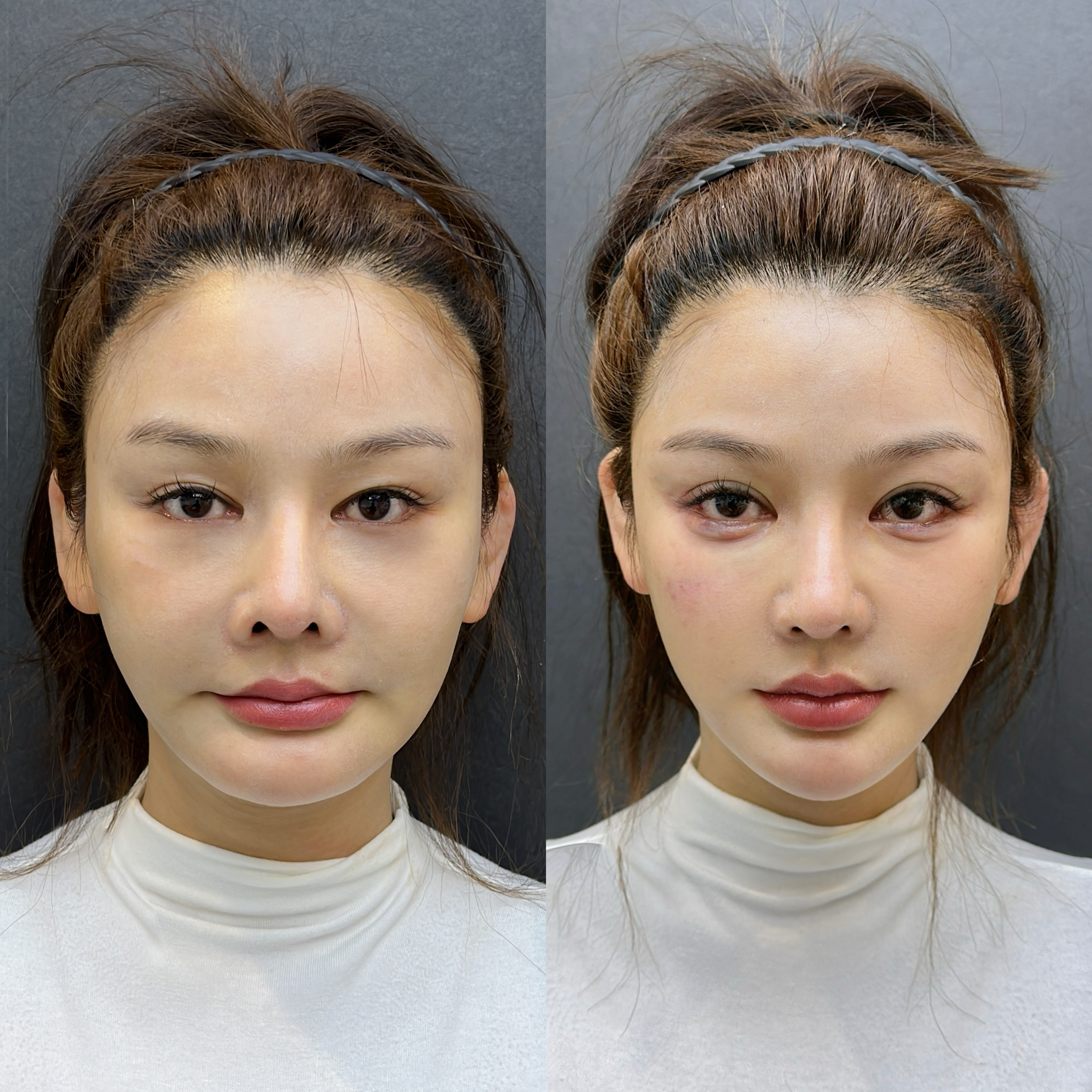 Injectable treatment case comparison