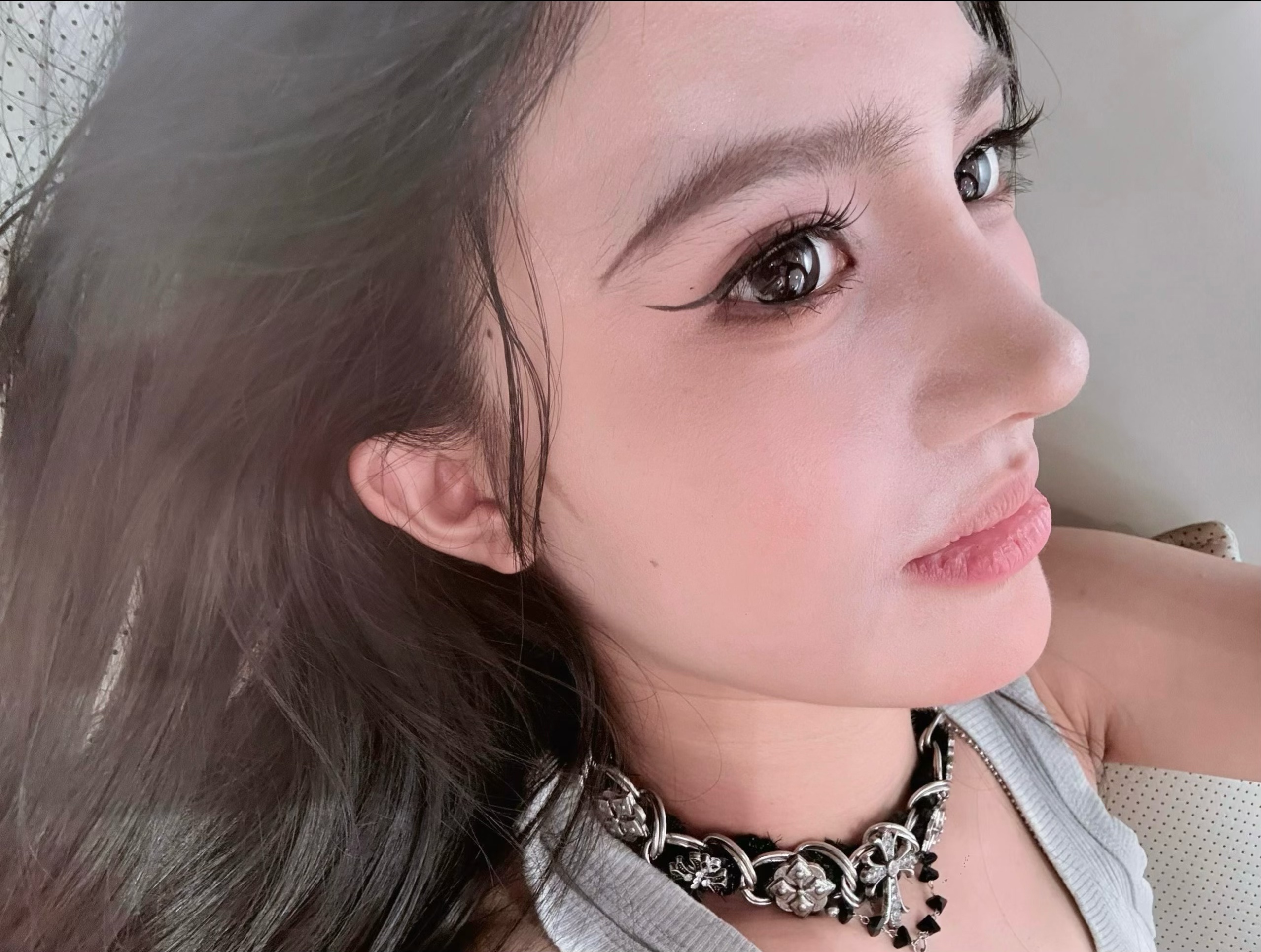 Rhinoplasty case portrait