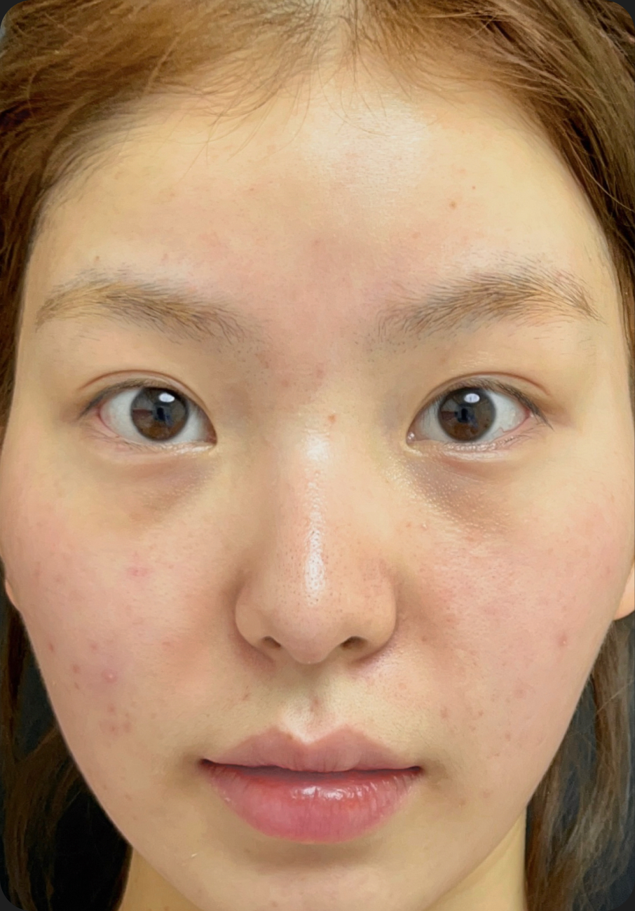 Injectable treatment before image