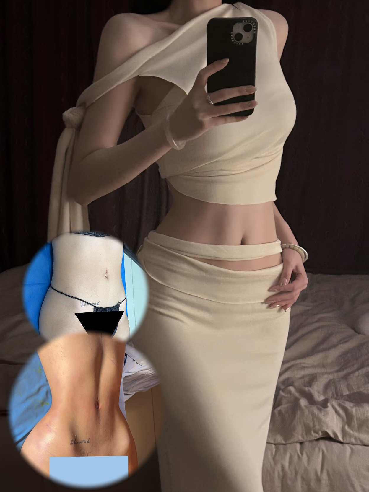 Body contouring result collage