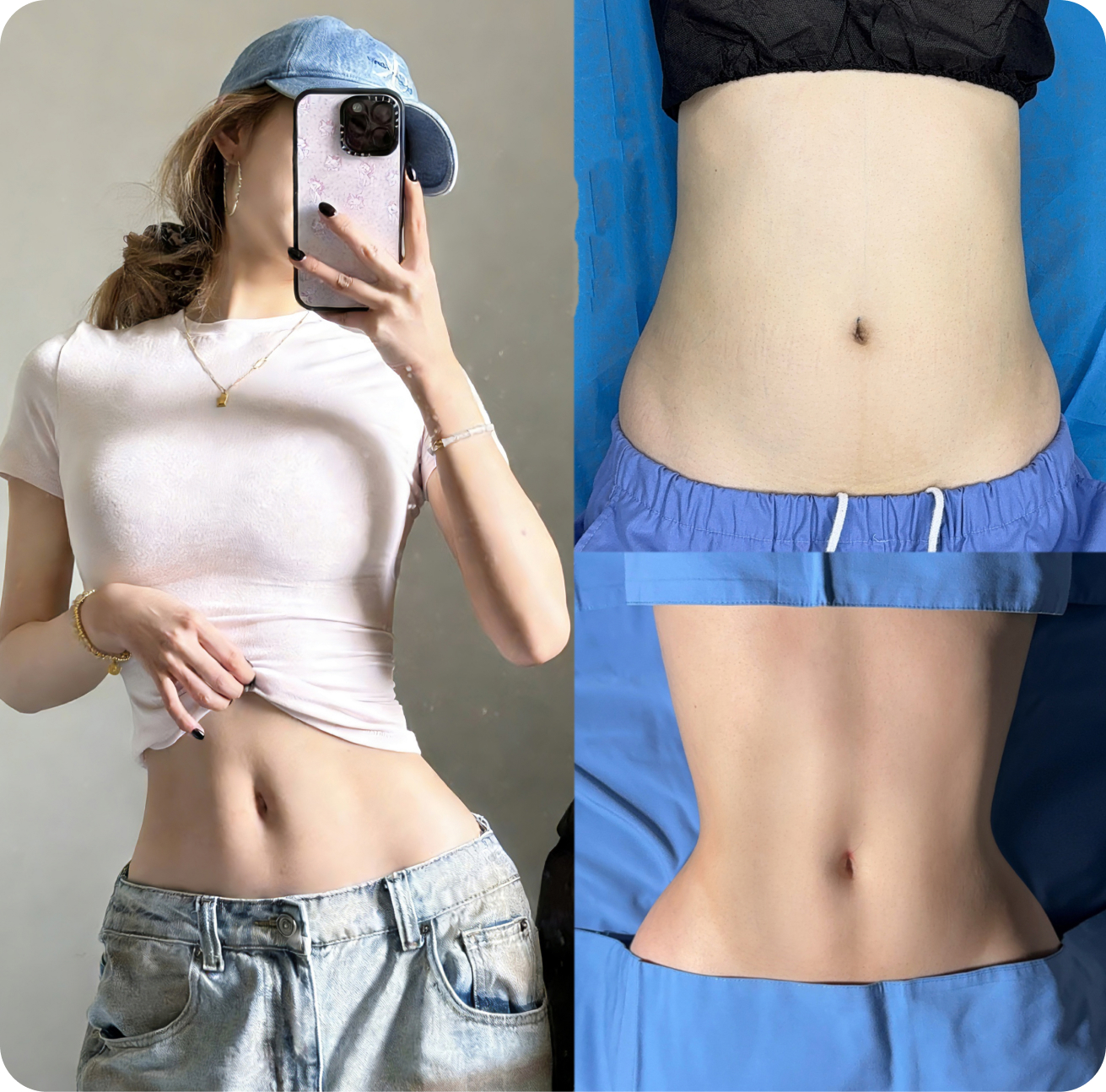 Waist contouring results