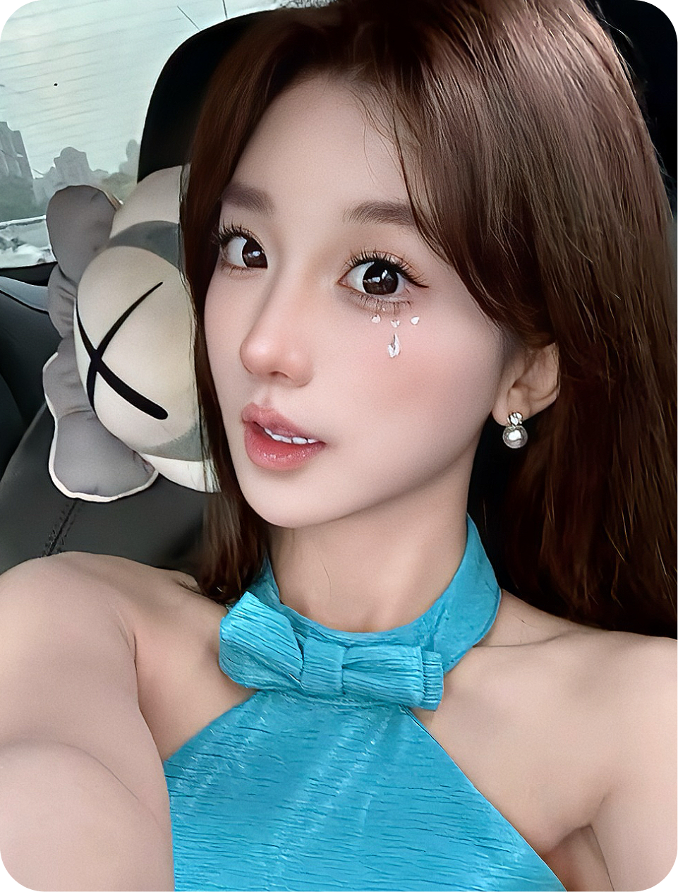 Rhinoplasty case portrait