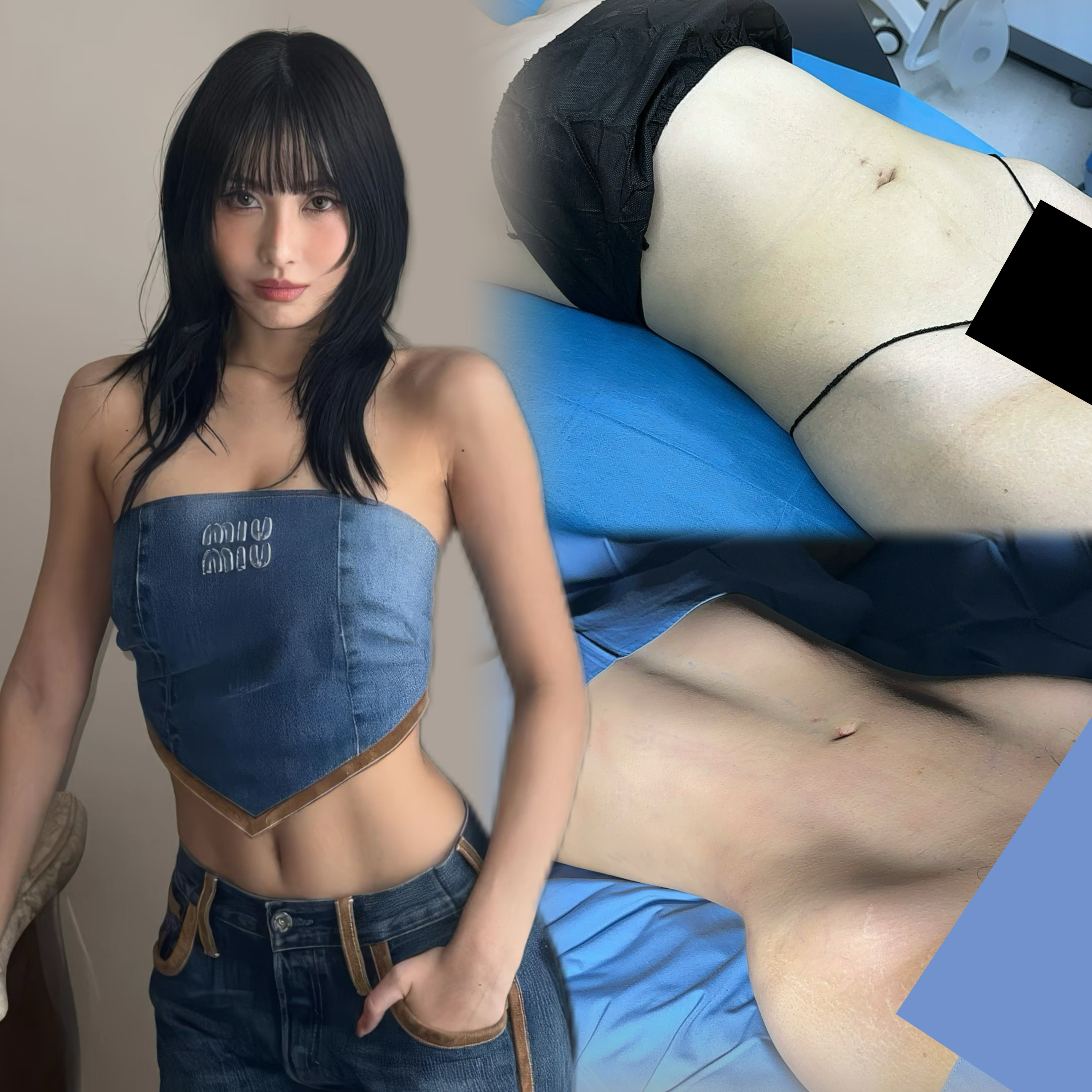 Body contouring clinical results
