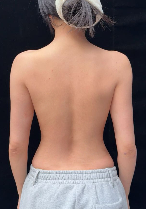 Angled waistline refinement after image