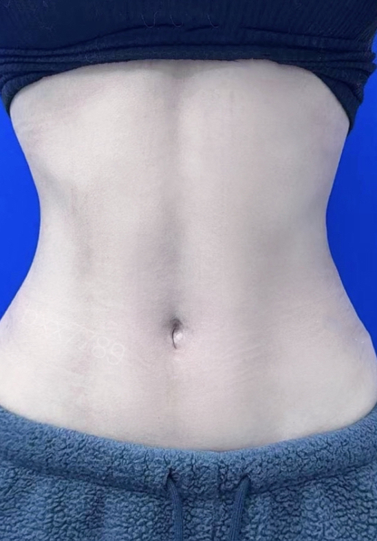 Waist angle definition after image