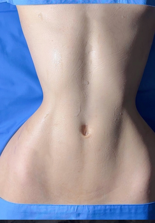 Waist angle definition before image