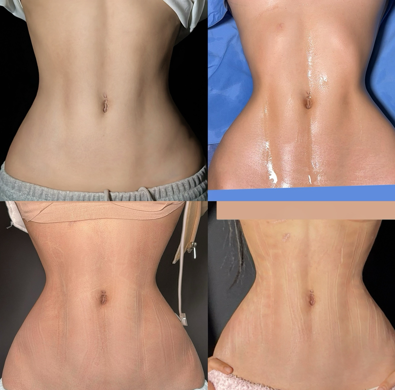Angled waistline front comparison