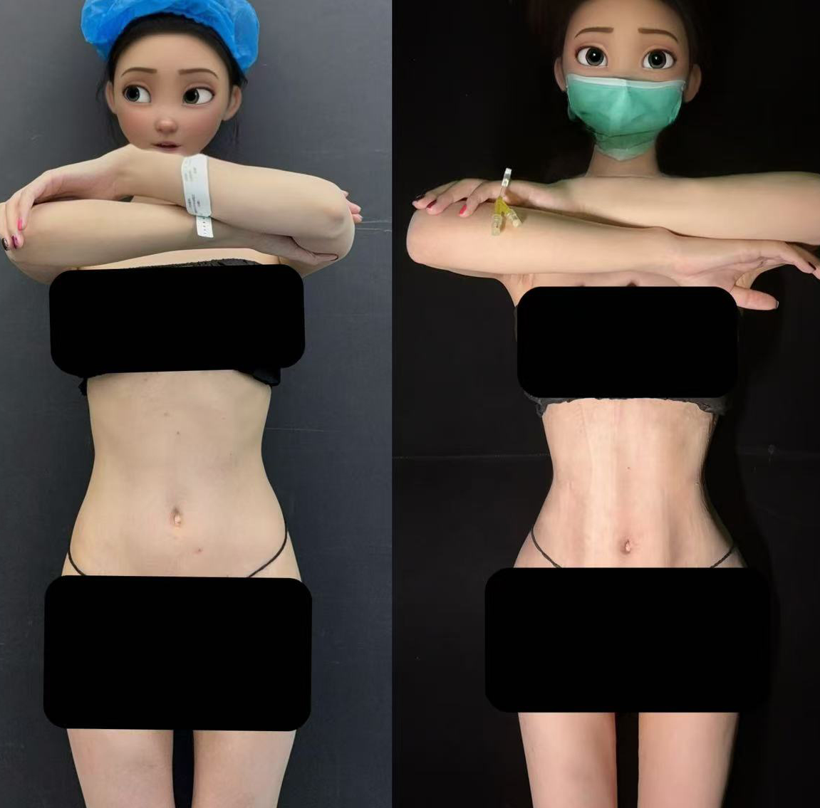 Waist angle front comparison